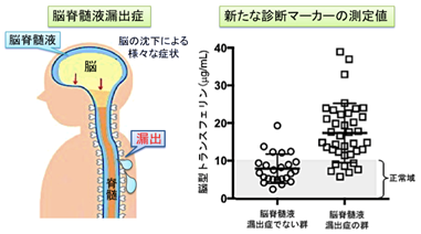 CSF JAPAN 脳脊髄液減少症ホームページ | 新情報